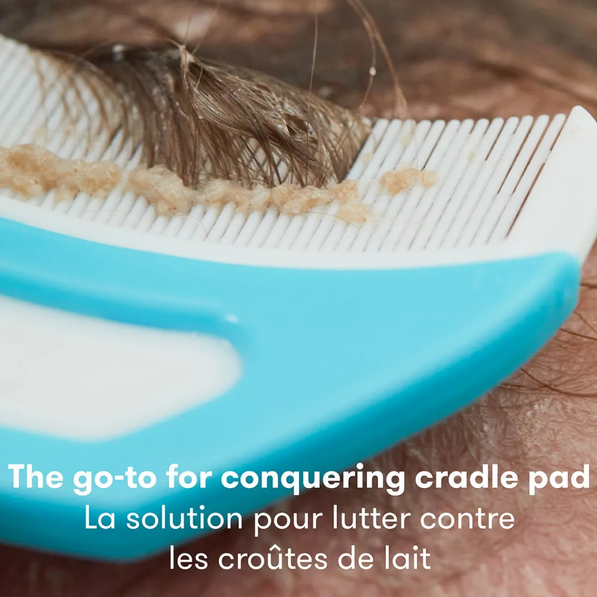 Cradle Cap Care-Fridababy DermaFrida Flake Fixer